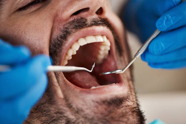 Best Emergency Dental Care for Broken or Chipped Teeth in Sussex, WI